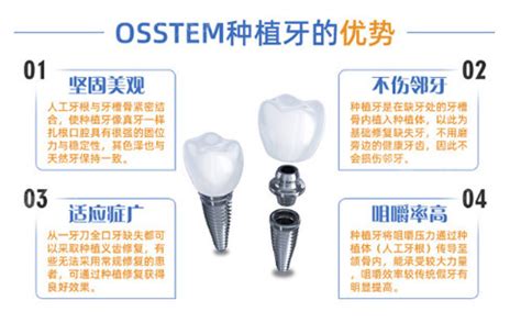 韩国奥齿泰种植牙多少钱一颗？揭秘韩国osstem种植体多少钱 贝色口腔