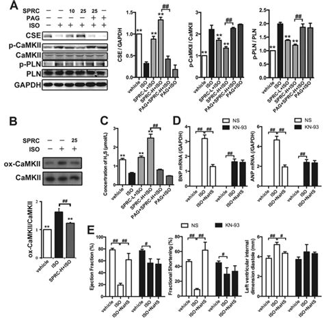 H 2 S Donor Improved Cardiac Function Through CaMKII Pathway A