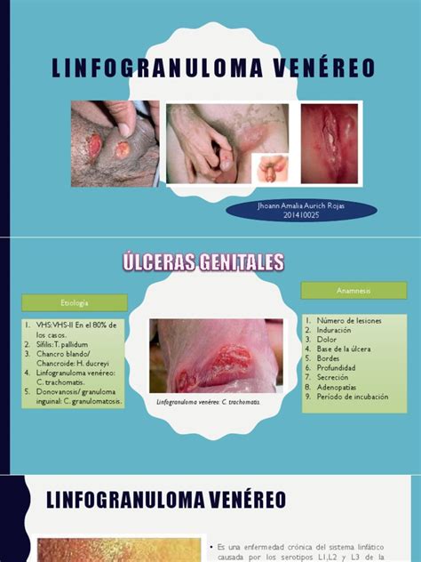 Linfogranuloma Venéreo Reproducción Humana Salud Pública