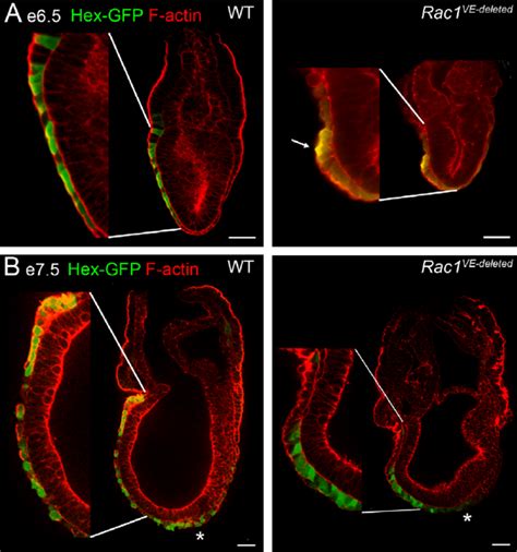 Epithelial organization of Rac1 VE-deleted embryos. Individual confocal ... 