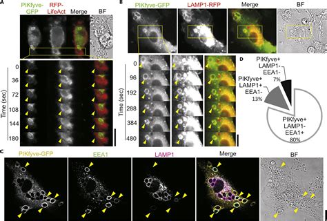 The Phosphoinositide Kinase Pikfyve Promotes Cathepsin S Mediated Major