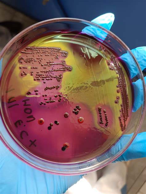 What type of bacteria could be in this EMB Levine plate? | ResearchGate