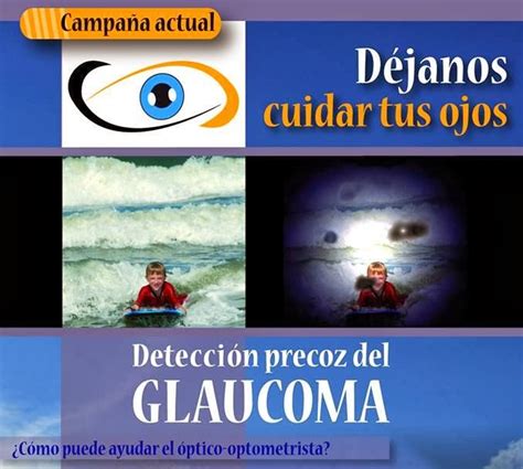 Cuida Tus Ojos Día Mundial Del Glaucoma