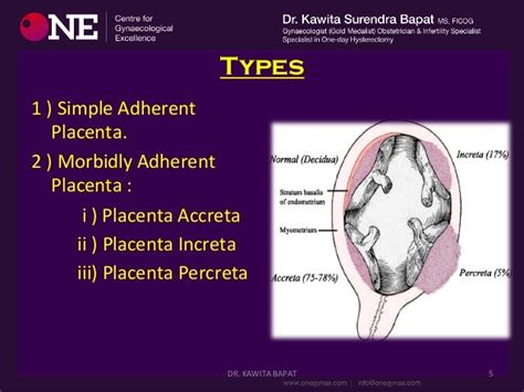 Adherent Placenta