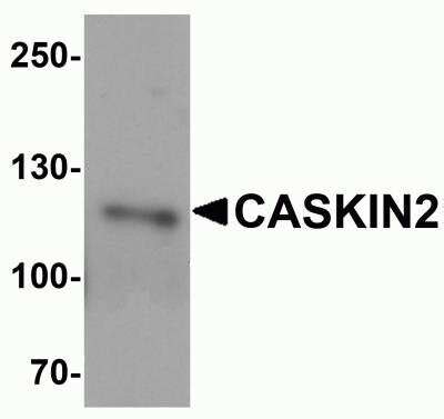 CASKIN2 Antibody BSA Free NBP2 81971 Bio Techne