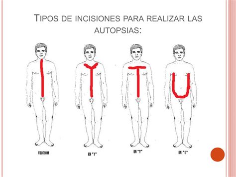 Definicion De Autopsia En Medicina Legal Ppt