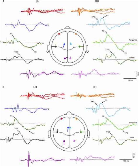 Source Current Waveforms For 8 Pair Besa Model Of A Left And B