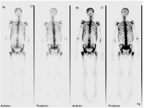 Radionuclide Imaging | Radiology Key