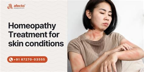 Homeopathy Treatment For Skin Conditions Afecto Homeopathy