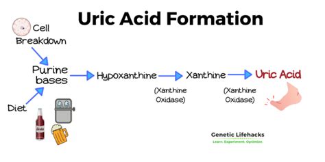 Genetic Links To High Uric Acid And Gout Genetic Lifehacks Genetic