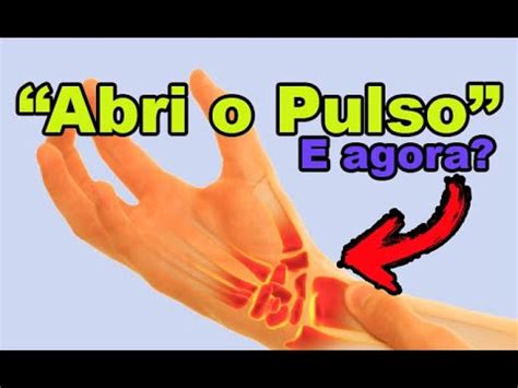 Como Tratar O Pulso Aberto - O que fazer quando se tem o pulso aberto? O que é pulso aberto como ...