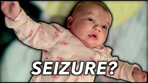 Luxury What Does A Seizure Look Like In A Baby