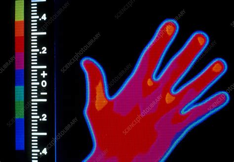 Thermogram Of A Human Hand Stock Image P Science Photo