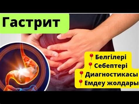 Гастрит дегеніміз не? | Емдеу жолдары - YouTube