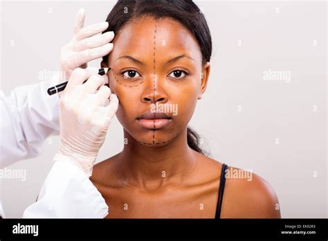 Cosmetic Surgeon Drawing Lines On African Girl Face For Plastic Surgery