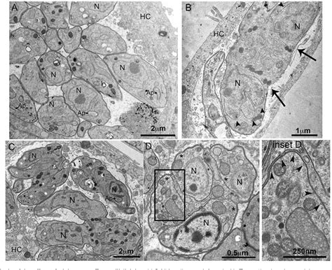 Figure 2 from Apicoplast fatty acid synthesis is essential for pellicle ... 