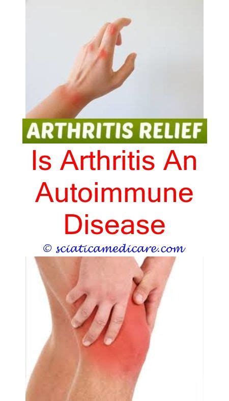 What Is Biological Treatment For Rheumatoid Arthritis Arthritis Caused