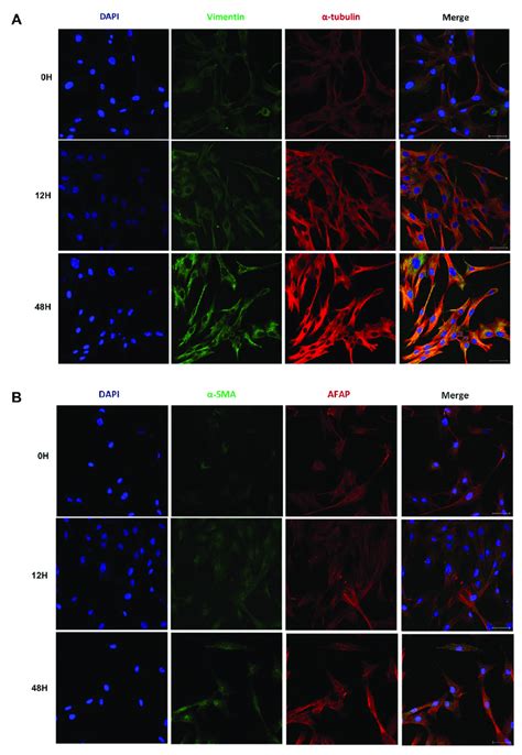 Expression Of Phenotypic Markers Of Emt Under Hypoxia A