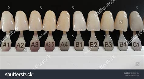 Veneers Color Chart Cosmetic Teeth 5 Reasons To Get Veneers