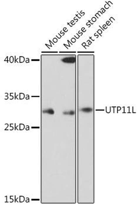 Anti Utp11l 抗体 Cab18455 Assay Genie