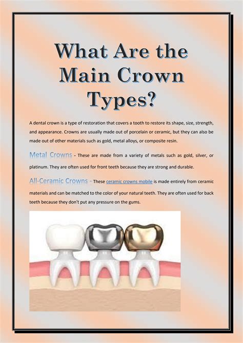 What Are the Main Crown Types? by loots4rs - Issuu