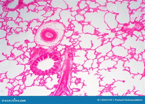 Tissu De Poumon Humain Sous La Vue De Microscope Photo stock - Image du ...