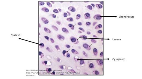 Lacuna Anatomy - Anatomy Reading Source