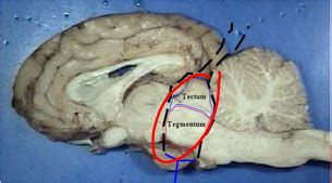 Sheep Brain Lab Practical Flashcards Quizlet