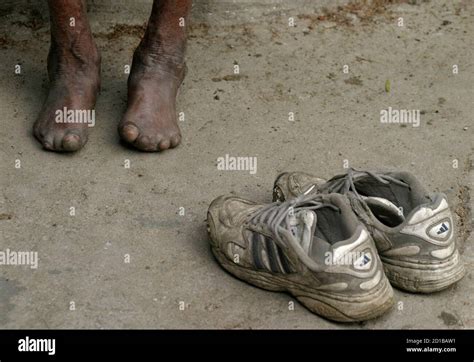 Indian leper hi-res stock photography and images - Alamy