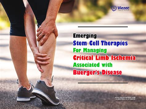 Emerging Stem Cell Therapies For Managing Critical Limb Ischemia