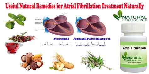 Useful Natural Remedies For Atrial Fibrillation Treatment Naturally