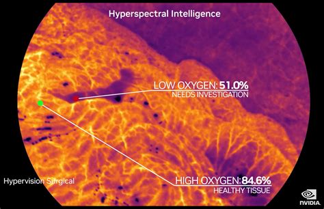 Hypervision Surgical Scoops 6 5m For AI Medical Imaging