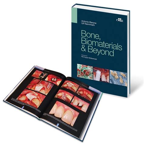 Bone Biomaterials And Beyond Book Dental Chiropody Products