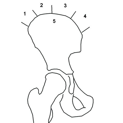 Orthoforum Idiopathische Skoliose