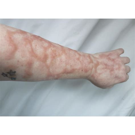 Makeup Scars Wounds | Makeupview.co