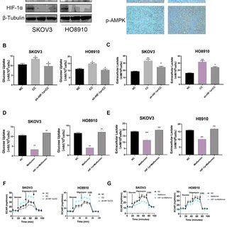 Trpm Silencing Reduces The Expression Of Glycolysis Related