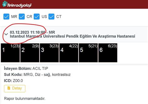 Marmara Üniversitesi Pendik Eğitim ve Araştırma Hastanesi MR Sonucunun