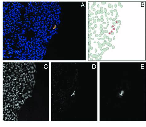 A Confocal analysis of DiI labeled embryonic murine RXRα