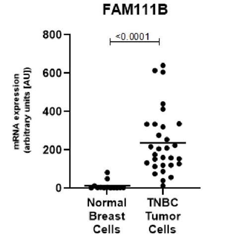 FAM111B Is Expressed At Significantly Higher Levels In Primary TNBC