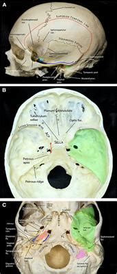 Frontiers Comprehensive Microsurgical Anatomy Of The Middle Cranial