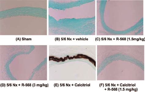 Von Kossastained Sections Of The Aorta In Sham Operated Rats A And Download Scientific