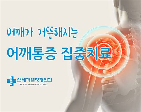 베스트 1021 어깨 통증 완화 운동 새로운 업데이트 50 분 전