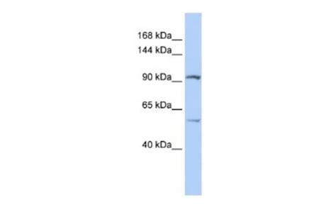 LRRC66 Rabbit anti-Human, Polyclonal, Novus Biologicals 0.1ml ...