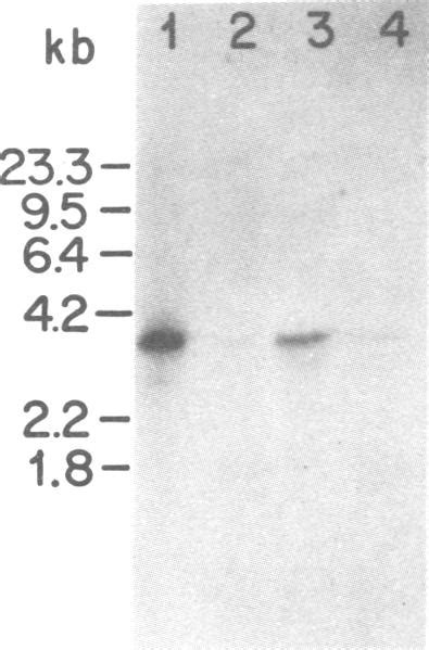 Hybridization Of 32p Labeled P53k 3 To Polyarna From Ut 1 Cells And