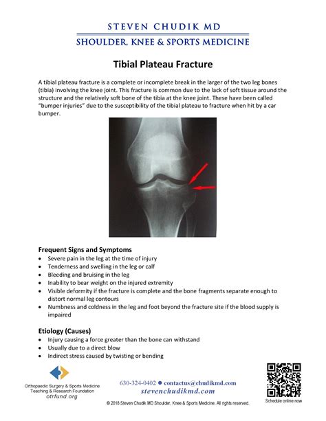 Tibial Plateau Fracture: Causes, Symptoms, And Treatment, 54% OFF