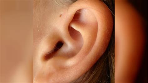 Seno Preauricular ¿qué Es Y Por Qué Algunas Personas Tienen Este