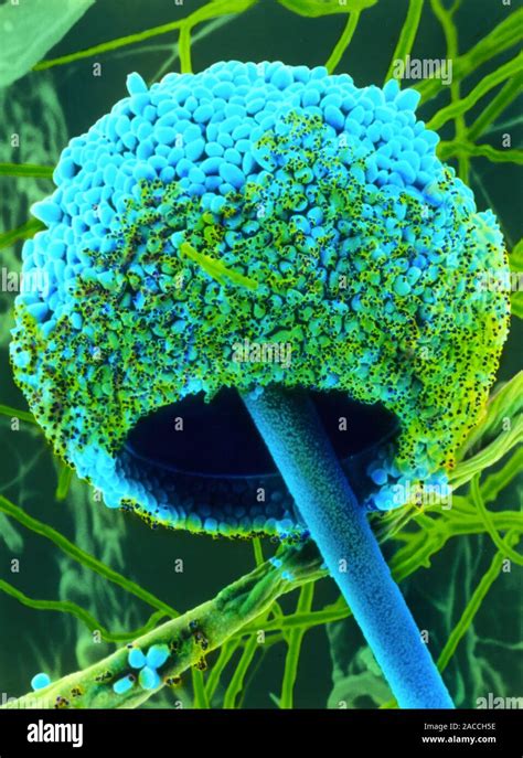 Bread Mould Sporangium Colour Scanning Electron Micrograph Of A Mature