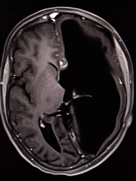 Pin su Radiology interesting cases and Spotters