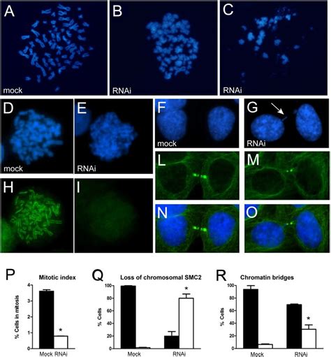 Mitotic Defects After Rnai Depletion Of Cfdp1 In Hela Cells A