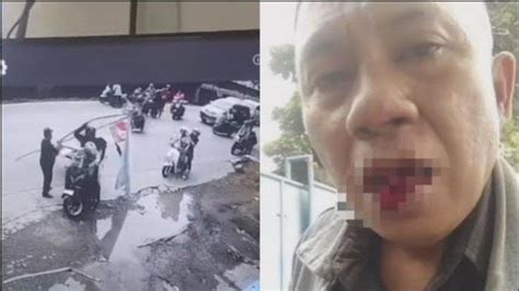 Viral Baliho Caleg Ambruk Lalu Timpa Pengendara Motor Korban Alami